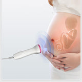 fetal heartbeat monitor doppler fetal monitor